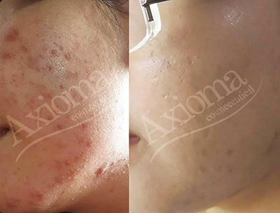 White Dtox Cream