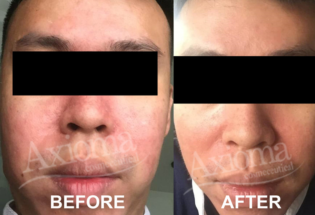 SOS Balm